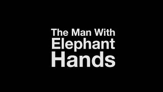 The Man With Elephant Hands előzetes