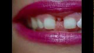 Gap-Toothed Women előzetes