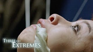 Extrém esetek előzetes