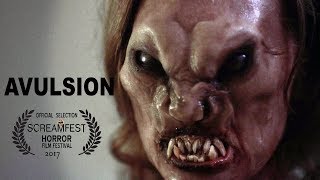Avulsion előzetes